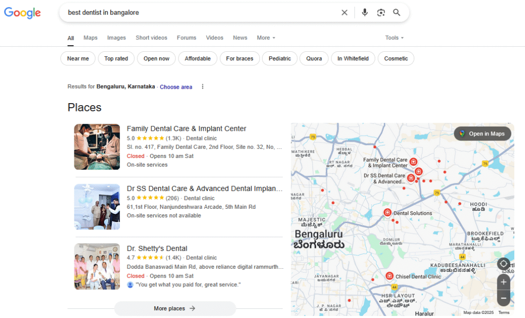 best-dentist-in-banglore-result
